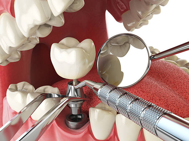 Best Walk-In Emergency Dental Services in Darien, GA